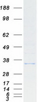 CYB5R1 Protein - Purified recombinant protein CYB5R1 was analyzed by SDS-PAGE gel and Coomassie Blue Staining