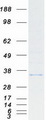 CYB5R1 Protein - Purified recombinant protein CYB5R1 was analyzed by SDS-PAGE gel and Coomassie Blue Staining
