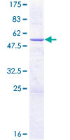 CYB5R2 Protein - 12.5% SDS-PAGE of human CYB5R2 stained with Coomassie Blue