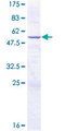 CYB5R2 Protein - 12.5% SDS-PAGE of human CYB5R2 stained with Coomassie Blue
