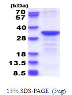 CYB5R2 Protein