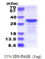 CYB5R2 Protein