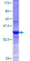 CYB5R3 / B5R Protein - 12.5% SDS-PAGE Stained with Coomassie Blue.
