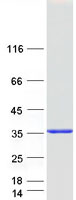 CYB5R3 / B5R Protein - Purified recombinant protein CYB5R3 was analyzed by SDS-PAGE gel and Coomassie Blue Staining
