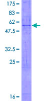 CYBA / p22phox Protein - 12.5% SDS-PAGE of human CYBA stained with Coomassie Blue