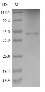 CYBB / NOX2 / gp91phox Protein - (Tris-Glycine gel) Discontinuous SDS-PAGE (reduced) with 5% enrichment gel and 15% separation gel.