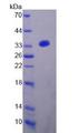 CYBB / NOX2 / gp91phox Protein - Recombinant  Cytochrome b-245 Beta Polypeptide By SDS-PAGE