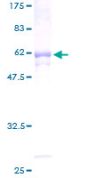 CYC1 / Cytochrome C-1 Protein - 12.5% SDS-PAGE of human CYC1 stained with Coomassie Blue