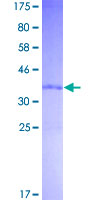 CYCS / Cytochrome c Protein - 12.5% SDS-PAGE of human CYCS stained with Coomassie Blue
