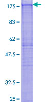 CYFIP2 / PIR121 Protein - 12.5% SDS-PAGE of human CYFIP2 stained with Coomassie Blue
