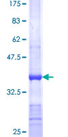 CYFIP2 / PIR121 Protein - 12.5% SDS-PAGE Stained with Coomassie Blue.