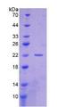 CYFRA21-1 Protein - Recombinant Cytokeratin Fragment Antigen 21-1 By SDS-PAGE