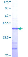 CYGB / Cytoglobin Protein - 12.5% SDS-PAGE Stained with Coomassie Blue.