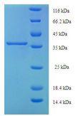 CYGB / Cytoglobin Protein