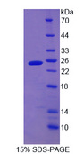 CYGB / Cytoglobin Protein - Recombinant Cytoglobin By SDS-PAGE