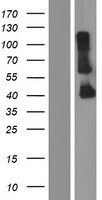 CYHR1 Protein - Western validation with an anti-DDK antibody * L: Control HEK293 lysate R: Over-expression lysate