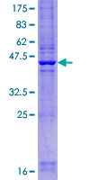 CYHR1 Protein - 12.5% SDS-PAGE of human CYHR1 stained with Coomassie Blue