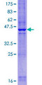 CYHR1 Protein - 12.5% SDS-PAGE of human CYHR1 stained with Coomassie Blue