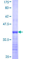 CYLD Protein - 12.5% SDS-PAGE Stained with Coomassie Blue.