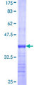 CYLD Protein - 12.5% SDS-PAGE Stained with Coomassie Blue.