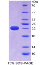 CYLD Protein - Recombinant Cylindromatosis By SDS-PAGE