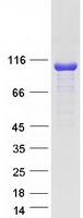 CYLD Protein - Purified recombinant protein CYLD was analyzed by SDS-PAGE gel and Coomassie Blue Staining