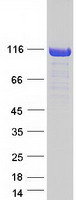 CYLD Protein - Purified recombinant protein CYLD was analyzed by SDS-PAGE gel and Coomassie Blue Staining