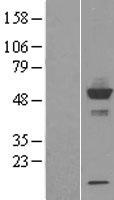 CYP-M / CYP20A1 Protein - Western validation with an anti-DDK antibody * L: Control HEK293 lysate R: Over-expression lysate