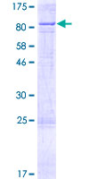 CYP11B1 Protein - 12.5% SDS-PAGE of human CYP11B1 stained with Coomassie Blue