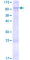 CYP11B1 Protein - 12.5% SDS-PAGE of human CYP11B1 stained with Coomassie Blue