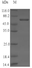 CYP11B2 / Aldosterone Synthase Protein - (Tris-Glycine gel) Discontinuous SDS-PAGE (reduced) with 5% enrichment gel and 15% separation gel.