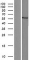 CYP17 / CYP17A1 Protein - Western validation with an anti-DDK antibody * L: Control HEK293 lysate R: Over-expression lysate