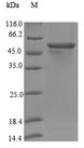 CYP17 / CYP17A1 Protein - (Tris-Glycine gel) Discontinuous SDS-PAGE (reduced) with 5% enrichment gel and 15% separation gel.