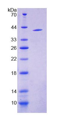 CYP17 / CYP17A1 Protein - Recombinant 17-Alpha-Hydroxylase By SDS-PAGE