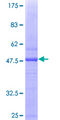 CYP19 / Aromatase Protein - 12.5% SDS-PAGE of human CYP19A1 stained with Coomassie Blue