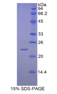 CYP19 / Aromatase Protein - Recombinant Aromatase By SDS-PAGE