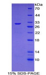 CYP1A1 Protein