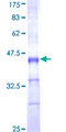 CYP1A2 Protein - 12.5% SDS-PAGE Stained with Coomassie Blue.