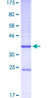 CYP1B1 Protein - 12.5% SDS-PAGE Stained with Coomassie Blue.