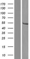 CYP21A2 Protein - Western validation with an anti-DDK antibody * L: Control HEK293 lysate R: Over-expression lysate