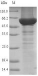 CYP21A2 Protein - (Tris-Glycine gel) Discontinuous SDS-PAGE (reduced) with 5% enrichment gel and 15% separation gel.
