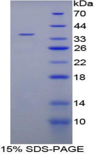 CYP21A2 Protein - Recombinant Cytochrome P450 21B By SDS-PAGE