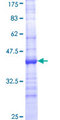 CYP24 / CYP24A1 Protein - 12.5% SDS-PAGE Stained with Coomassie Blue.