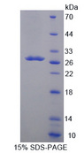 CYP24 / CYP24A1 Protein - Recombinant  Cytochrome P450 24A1 By SDS-PAGE