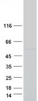 CYP26 / CYP26A1 Protein - Purified recombinant protein CYP26A1 was analyzed by SDS-PAGE gel and Coomassie Blue Staining