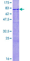 CYP26B1 Protein - 12.5% SDS-PAGE of human CYP26B1 stained with Coomassie Blue