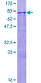 CYP26B1 Protein - 12.5% SDS-PAGE of human CYP26B1 stained with Coomassie Blue