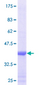CYP26B1 Protein - 12.5% SDS-PAGE Stained with Coomassie Blue.