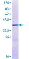 CYP26C1 Protein - 12.5% SDS-PAGE Stained with Coomassie Blue.