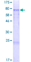 CYP27 / CYP27A1 Protein - 12.5% SDS-PAGE of human CYP27A1 stained with Coomassie Blue